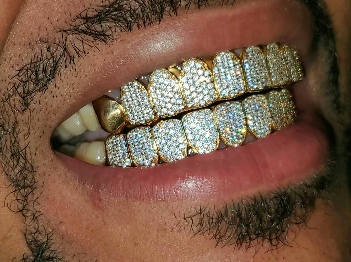 Cz iced top out grillz