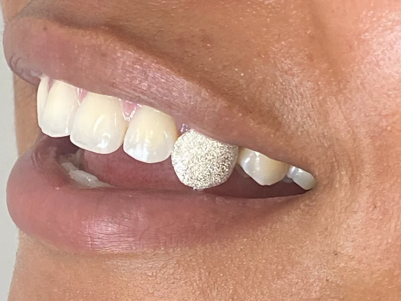 Find the Perfect Grillz for Your Personal Style at Grillz Montreal