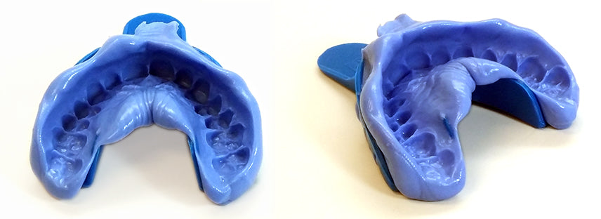 Your Ultimate Guide to Perfect Dental Impressions