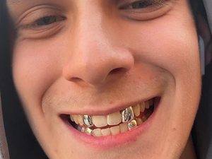 Step-by-Step Guide on How Custom Grillz are Made