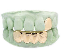 YELLOW GOLD DIPPED Grillz