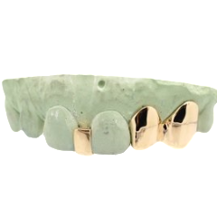 Spacer with 2 Piece Set