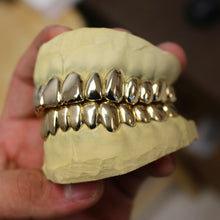 Traditional Gold Grillz