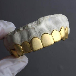 Gold Matte Grillz Tops Toronto