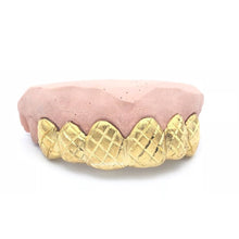 Yellow Gold DIPPED Pineapple Cuts - Grillz Montreal