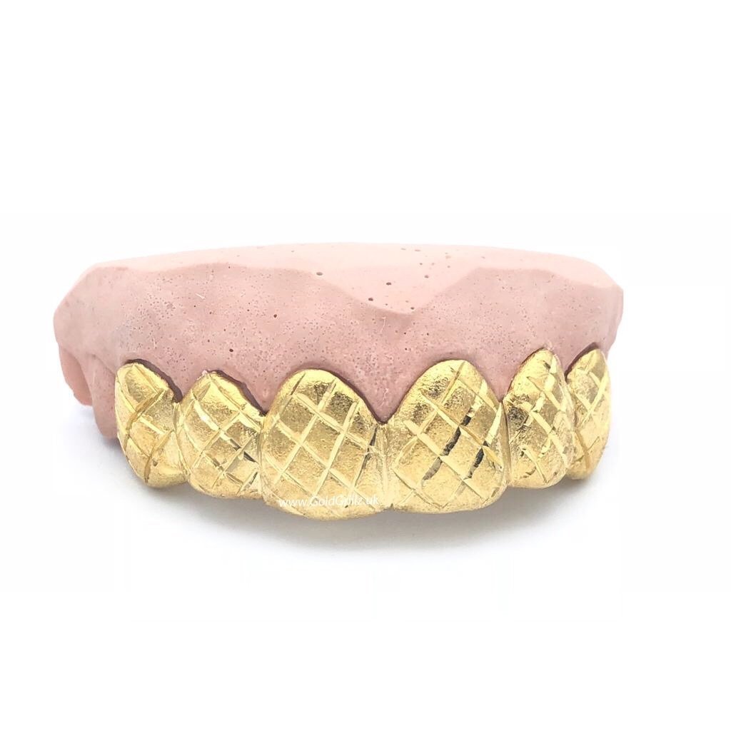 Yellow Gold DIPPED Pineapple Cuts - Grillz Montreal