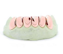 Rose Gold Dipped Bottom Grillz Montreal
