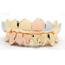 Tri-Color Grillz Set: Rose, White, Yellow